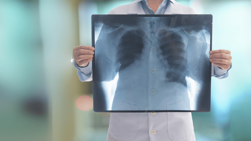 How Do You BEAT Lung Cancer?